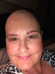 This lovely lady has gone thru a lot over the years. Skin damage and  necessary surgeries have left her with scaring and no eyebrows… I was  honored to give her brows back