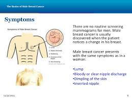 You may notice some irregularities develop on your chest or breast (s) as a result of male breast cancer. Male Breast Cancer Yeah You Read It Right Steemit