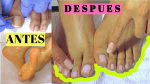 Uñas largas si aluna vez se te ha olvidado cortarte las uñas y crees que son muy largas, es momento de redefinir tu concepto de largo, pues en este video te. Asi Me Cuido Mis Unas De Los Pies My Pedicure Rutine Como Limpiar Las Unas Youtube