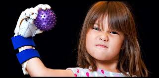 The chest wall defect is often associated with a. Girl With Printed Hand Aims To Pitch In Every Mlb Stadium Littlethings Com
