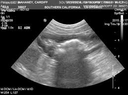 What are the signs of intestinal tumors? When Cancer Returns After Remission In Dog Petmd