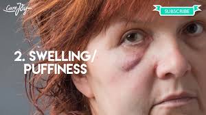 Wolves restored balance in Yellowstone, showing nature's intricate cycle.  When wolves were reintroduced to the park, they helped control elk  populations, which allowed vegetation to thrive, stabilized riverbanks, and  brought back more