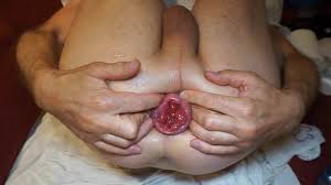 Vídeos porno gay de clairet anal prolapse gratis en xHamster para 2025.  ¡Nuevos vídeos cada día!, 3 | xHamster