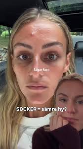 Är det verkligen sockret eller är det andra förändringar? 🤔, #hälsa #hud  #hudvård #kost