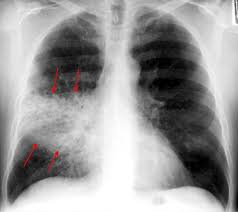 Smartfiches Medecine Smartfiches