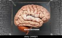 Résultat de recherche d'images pour "borne un cerveau sur pattes"