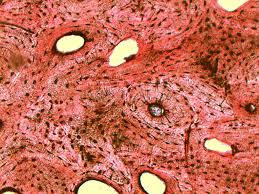 Labeled diagram of an osteon. Compact Bone 10x Original Histology