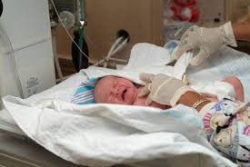 Definisi pembuangan bayi ini adalah mengikut kamus dewan edisi 4, halaman 208, perkataan yang lebih jelas lagi tentang masalah pembuangan bayi ini. Atresia Ani Gejala Penyebab Dan Mengobati Alodokter