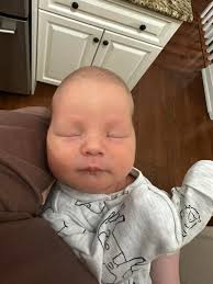 Is this normal? She was born at 37wks via c section, had this right from  birth. Worried about craniosynotosis. The ridge is hard