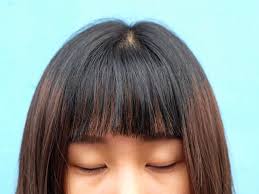 Ada cukuran model rambut pendek, top knot, korea, tni, comb over. Cara Mengatasi Jerawat Di Dahi Akibat Rambut Berponi