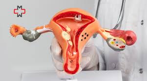 Image result for Cyst