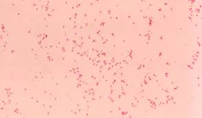 Image result for Micrargeriella