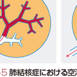 Maybe you would like to learn more about one of these? è‚ºçµæ ¸ç—‡ã¨ã¯ ã‚³ãƒˆãƒãƒ³ã‚¯