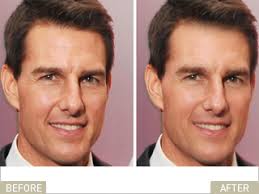 Since then, he's worn a prosthetic nose to hide the huge. Tom Cruise Says No To Plastic Surgery Newbeauty
