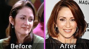 30.05.2018 · in 2015, the vanderpump rules star chose to undergo the plastic surgery operation to reduce her breast size from a ddd to a regular d, which she calls one of … Patricia Heaton Plastic Surgery Photos