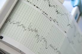 Sortieren nach relevanz | aktualität. Ctg Der Herzton Wehenschreiber Alles In Ordnung Baby Eltern De