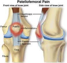 Pin On Symptoms And Conditions