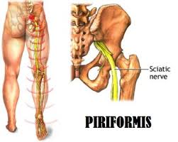 Sindrom Piriformis Sakit Bahagian Punggung