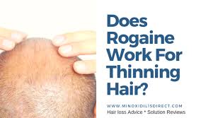 Help treat hair loss and regrow fuller hair with men's rogaine 5% minoxidil topical foam. Does Rogaine Work For Thinning Hair Minoxidil 15 Direct