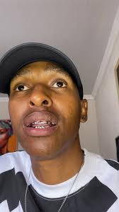 fake braces from clicks in south africa shein grillz teeth how much do  grills cost platinum teeth where to buy cheap grills for teeth how to make  grills for teeth grills teeth grills for teeth