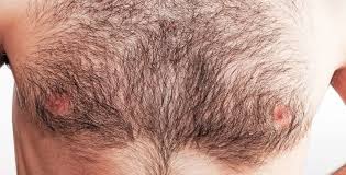Check if you have ingrown hair ingrown hairs can look like raised, red, itchy spots on the skin. How To Trim Chest Hair Without Itching 12 Crucial Tips Ready Sleek