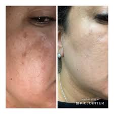 We did not find results for: Blam 945 Gangster Musely Crema Spot Barnmattor Net