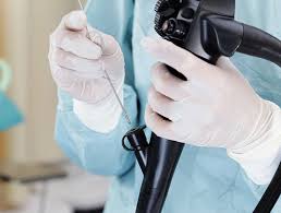 Cel mai frecvent apar la nivelul colonului, stomacului, esofagului, sinusurilor in general, prin „operatie cu laserul, oamenii inteleg operatie endoscopica sau laparascopica, adica fara taietura. Am Polipi Pe Colon Ce Fac Mai Departe Reginamaria Ro