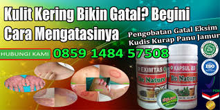 Check spelling or type a new query. Kulit Kering Bikin Gatal Begini Cara Mengatasinya