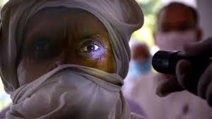 Indian mucormycosis has certain unique features. Hongo Negro Mucormicosis Asociado Al Coronavirus Que Es