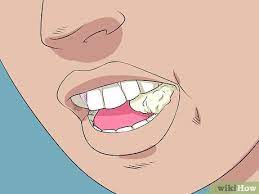 Il le relâche et me tète de plus en plus fort. 3 Manieres De Vous Arracher Une Dent Qui Bouge Wikihow