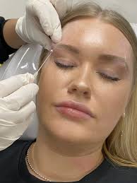 Fox Eye Brow Thread Lifts - Results Laser Clinic Eye Lifts From $180
