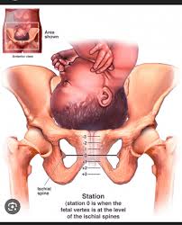 Membrane sweep success stories | BabyCenter
