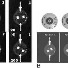 Maybe you would like to learn more about one of these? A Radiographic Appearance Of The Codman Hakim Programmable Valve Set Download Scientific Diagram
