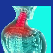 Pin On Lyme Fibromyalgia Info