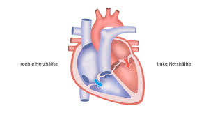 Die forscher raten daher dazu, dass sich leistungssportler nach einer infektion einem screening unterziehen, bevor sie wieder mit ihrem training beginnen. Linksherzinsuffizienz Ursachen Symptome Therapie Pflege De