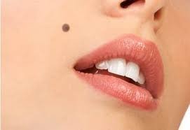 Kamu lebih mudah memperolehi kekayaan dalam hidup dan. Suterahati Rahsia Tahi Lalat