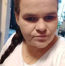 🎅 * KONKURS MIKOŁAJKOWY * 🎅 Przygotowaliśmy dla Was konkurs mikołajkowy,  w którym do wygrania jest zabieg pielęgnacyjny Botox. Aby wziąć udział w  konkursie należy spełnić takie oto warunki: 🎅 Polubić nasz