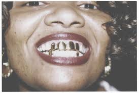 Mouth Full of Golds: la storia dimenticata di Eddie Plein