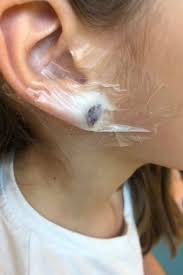 Generally, persistent pain is a more accurate indicator of infection than the level of pain. Girl 7 Hospitalised After Getting Ears Pierced At Claire S Accessories Mirror Online