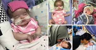 Penantian selama 9 bulan, berakhir sudah dengan hadirnya tangisan si kecil di pangkuan ibu. Luluh Hati Mummy Satu Lagi Ketumbuhan Di Buah Pinggang 3 Kali Jalani Pembedahan Bayi 3 Bulan Hidap Kanser Kini Tak Boleh Melihat Bersuara Keluarga