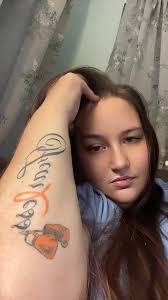 I'm 42, recently had a 14 day stay in the hospital, 3 bands found in spinal  tap, lesions by both optic nerves with dymyelinisation, 50% vision loss in  both eyes but blurred