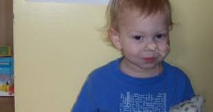 Rare Disease Day: Handprints across America