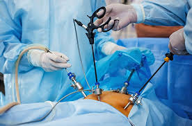 Star Hospitals Is One Of The Best Multi Specialty Hospitals In Hyderabad Which Provides The Best In Patient Care Laparoscopic Surgery Medical Errors Gynecology