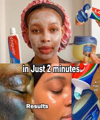 Natural Remedy for Sore Muscles and Dry Skin with Vaseline and Cloves