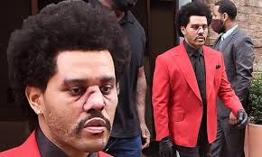 Anonymous content music video by the weeknd performing can't feel my face. The Weeknd Sports Bloody Makeup And Bandaged Nose On His Way To Rehearse For The Vma S In Nyc Daily Mail Online