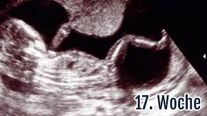 17 Ssw Die 17 Schwangerschaftswoche Gewicht Ultraschall Tipps Netmoms De