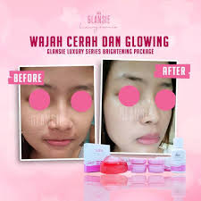 Ada beberapa perbedaan cream hn asli dengan yang palsu, diantaranya: Ciri Ciri Biosoft Jrg Asli Dan Kw Cantik Beauty Shop Facebook