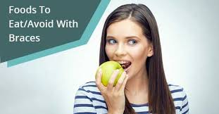 Foods to avoid with braces pdf. Best Food For Braces What To Eat What To Avoid