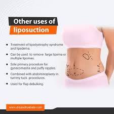 Know More About Liposuction In 2020 Liposuction Tummy Tuck Procedure Plastic Surgeon