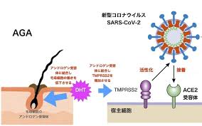 薄毛の人はコロナが重症化しやすい 忽那賢志 個人 Yahoo ニュース